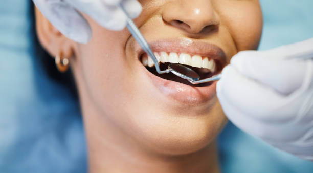 Best Emergency Treatment for Dental Infections or Abscesses in Cottonwood Shores, TX