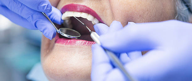 Best Emergency Root Canal Treatment in Cottonwood Shores, TX